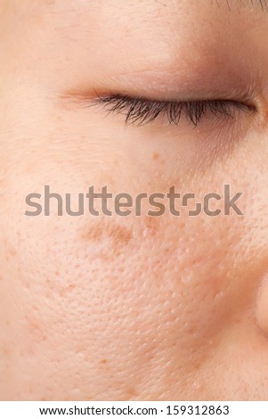 skin pores stock images royalty free images vectors skin pores stock images royalty free images vectors skin pores stock images royalty free images vectors skin pores stock images royalty free images vectors