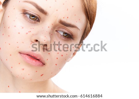 Woman with facial rash