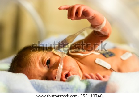 What can i do with stock options