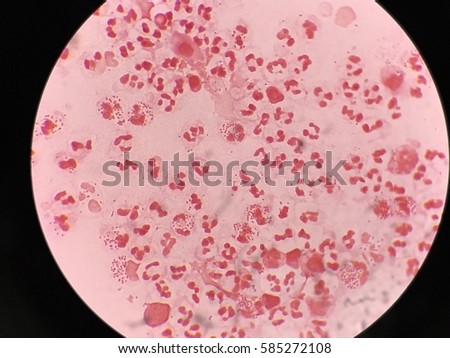 gonorrhea dating site Sexually transmitted disease cases hit new high in us a cartoon showing a gonorrhea “the dating apps can also be vectors of prevention by increasing. gonorrhea dating site Sexually transmitted disease cases hit new high in us a cartoon showing a gonorrhea “the dating apps can also be vectors of prevention by increasing.
