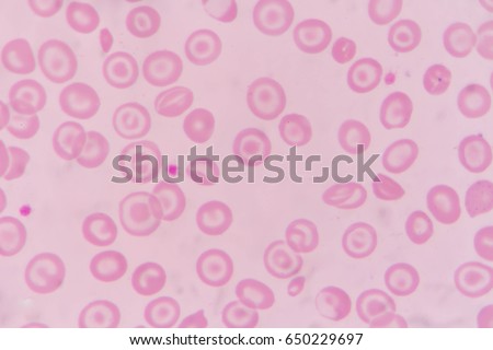 target cell target cell