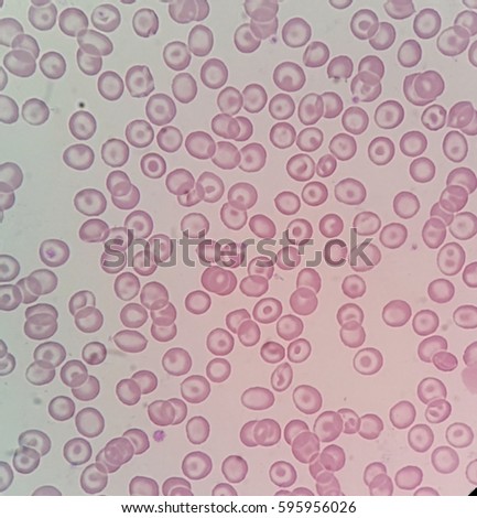 target cell target cell