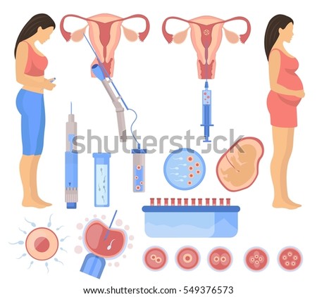 artificial insimination Artificial insemination (ai) is the process of collecting sperm cells from a male animal and artificially depositing them into the reproductive tract of a female. artificial insimination Artificial insemination (ai) is the process of collecting sperm cells from a male animal and artificially depositing them into the reproductive tract of a female.