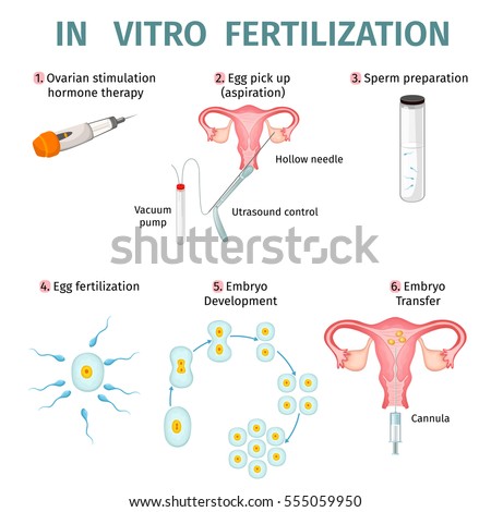 Medical Illustration Ovulation Stock Vector 85157233 - Shutterstock