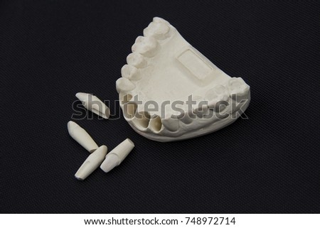 Upper Jaw Stock Images Royalty Free Images Vectors 