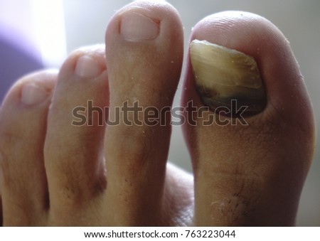 Knowing If You Re Pregnant Women With Hairy Feet