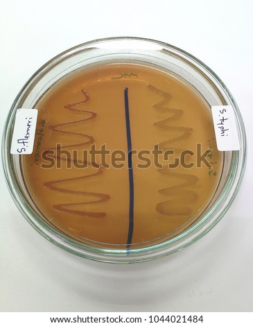 Shigella Stock Images, Royalty-Free Images & Vectors | Shutterstock