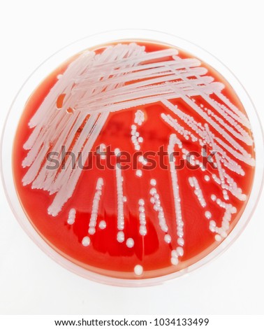 growing of bacteria on sheep and rabbit blood agar Defibrinated sheep, horse, pig, or goat blood agar is recommended for the citric acid is often used in the food industry to inhibit the growth of bacteria (8,. growing of bacteria on sheep and rabbit blood agar Defibrinated sheep, horse, pig, or goat blood agar is recommended for the citric acid is often used in the food industry to inhibit the growth of bacteria (8,.