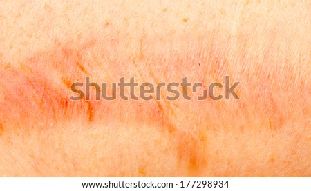 skin pores stock images royalty free images vectors skin pores stock images royalty free images vectors skin pores stock images royalty free images vectors skin pores stock images royalty free images vectors