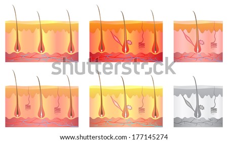 cross section human skin royalty free vector image skin cross section stock images royalty free images vectors cross section human skin royalty free vector image skin cross section stock images royalty free images vectors