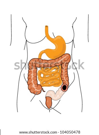 colostomy stoma position drawing sigmoid removal following end colon vector shutterstock bag ostomy