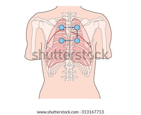 lung auscultation