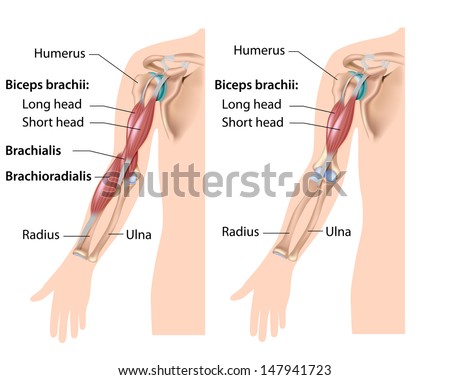 Upper body steroid injection