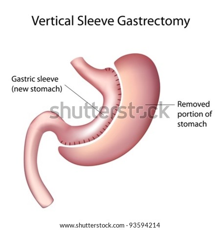 Hcg 1234 garcinia cambogia image 7