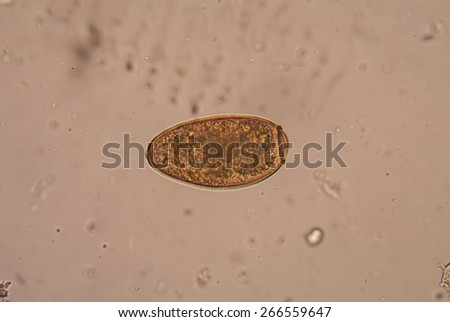 Trematoda Stock Photos, Royalty-Free Images & Vectors - Shutterstock