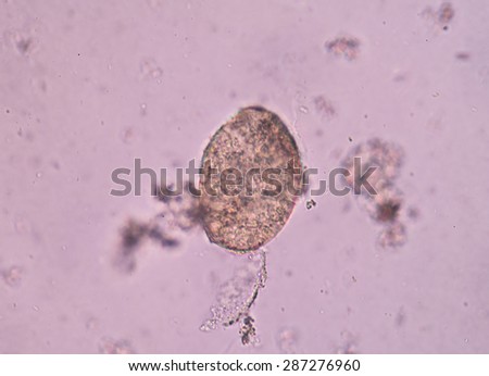 Schistosomiasis Stock Images, Royalty-Free Images & Vectors | Shutterstock