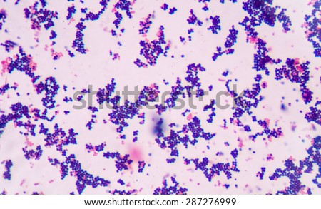 Gram Staining Called Grams Method Method Stock Photo (Royalty Free ...