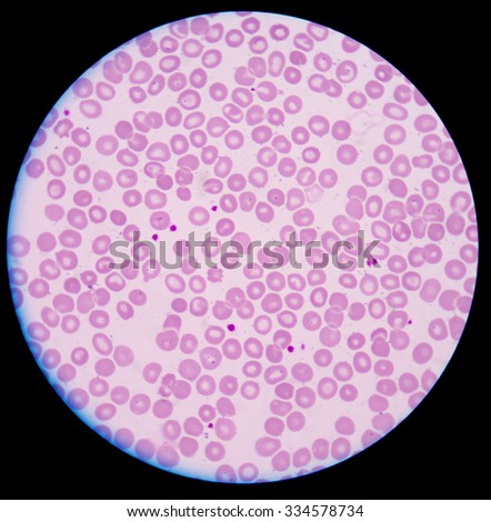 Platelets Stock Photos, Images, & Pictures | Shutterstock