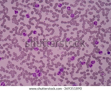 Neutrophil Stock Photos, Royalty-Free Images & Vectors - Shutterstock