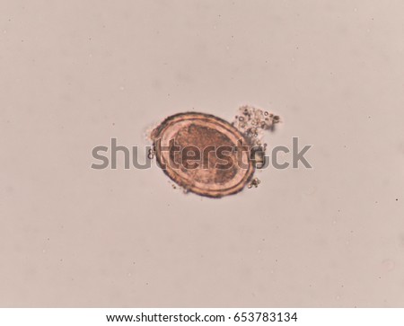Ascaris Stock Images, Royalty-Free Images & Vectors | Shutterstock