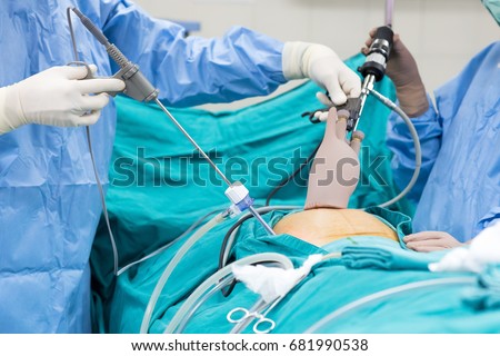 Laparoscopic Cholecystectomylc Mean Gallbladder Surgery Stock Photo ...