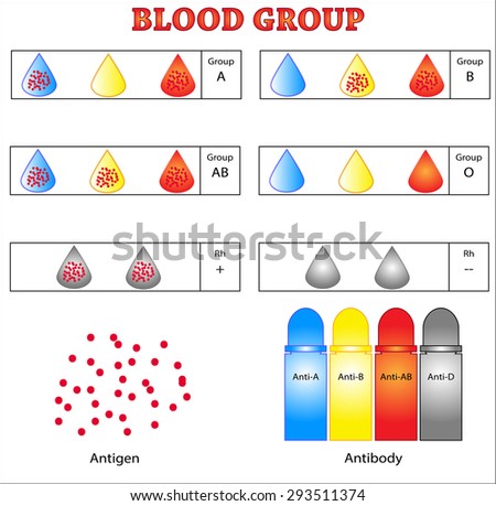 abo blood groups and race Different blood groups are more and less common, with stanford school of medicine calculating the proportions in the general population as follows. abo blood groups and race Different blood groups are more and less common, with stanford school of medicine calculating the proportions in the general population as follows.