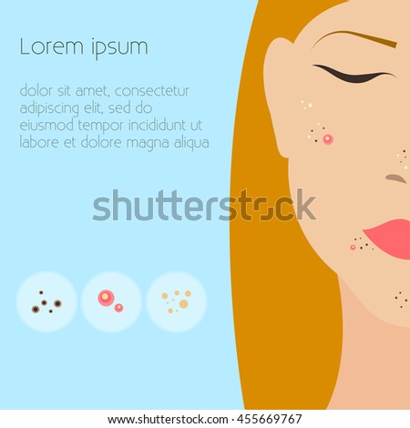 skin boils problems face shutterstock causes close acne pimples vector illustration