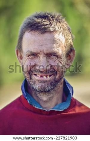 Edentulous Stock Images, Royalty-Free Images & Vectors | Shutterstock