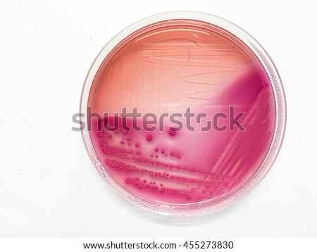 Escherichia Stock Photos, Royalty-Free Images & Vectors - Shutterstock