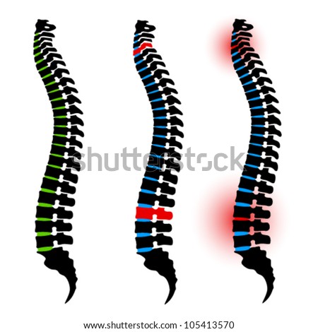 vector human spine silhouettes