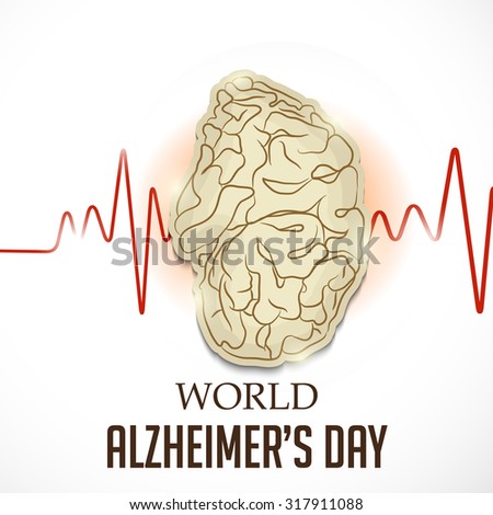 alzheimer’s day Alzheimer's disease synonyms: alzheimer disease, alzheimer's: comparison of a normal aged brain (left) and the brain of a person with alzheimer's (right. alzheimer’s day Alzheimer's disease synonyms: alzheimer disease, alzheimer's: comparison of a normal aged brain (left) and the brain of a person with alzheimer's (right.