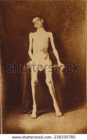 nude-men-in-the-civil-war-young-nudists-in-love
