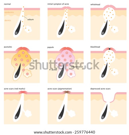 skin pores stock images royalty free images vectors skin pores stock images royalty free images vectors skin pores stock images royalty free images vectors skin pores stock images royalty free images vectors