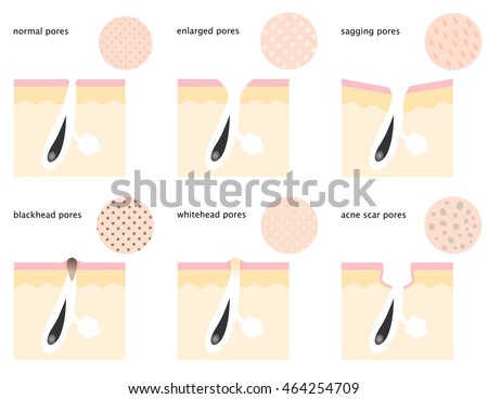 skin pores stock images royalty free images vectors diagram skin pores normal sagging open stock vector royalty free 464254709 skin pores stock images royalty free images vectors diagram skin pores normal sagging open stock vector royalty free 464254709