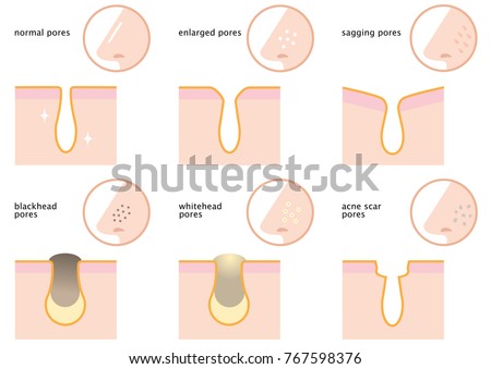 skin pores stock images royalty free images vectors set skin pores on nose normal stock vector 767598376 skin pores stock images royalty free images vectors set skin pores on nose normal stock vector 767598376
