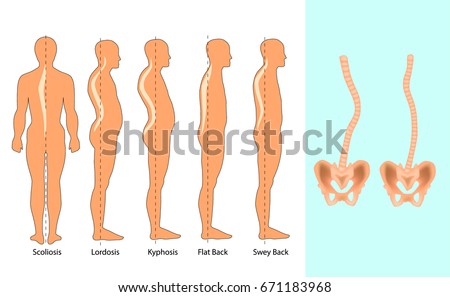 types of postures