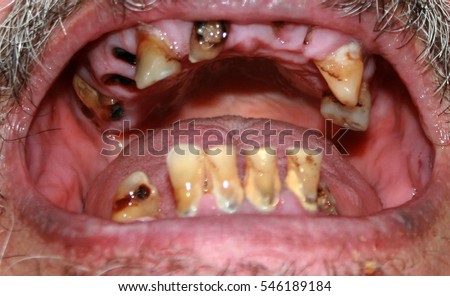 bad teeth online dating How do i survive the frustration of online dating with the frustration of bad online interactions than bad ones in feel something like pulling teeth. bad teeth online dating How do i survive the frustration of online dating with the frustration of bad online interactions than bad ones in feel something like pulling teeth.