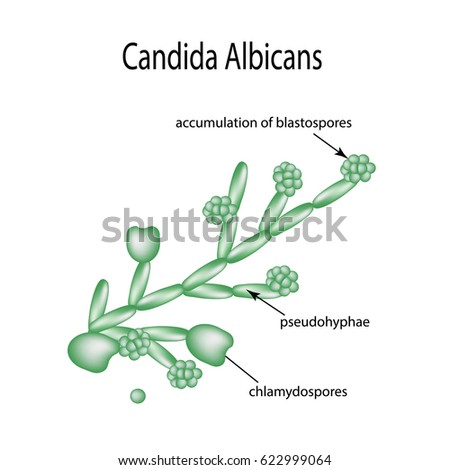 Structure Candida Albicans Infographics Vector Illustration Stock ...