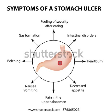 Symptoms Stomach Ulcer Infographics Vector Illustration Stock Vector ...