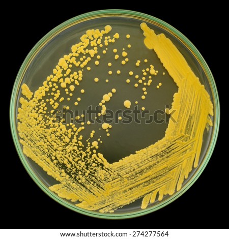 Bacterial colonies Stock Photos, Images, & Pictures | Shutterstock