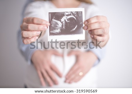Women holding ultrasound picture of her future daughter in the arms of her husband Women holding ultrasound picture of her future daughter in the arms of her husband