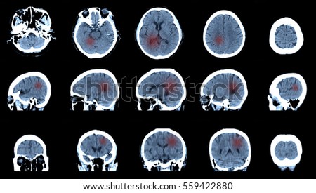 Sagittal Stock Images, Royalty-Free Images & Vectors | Shutterstock