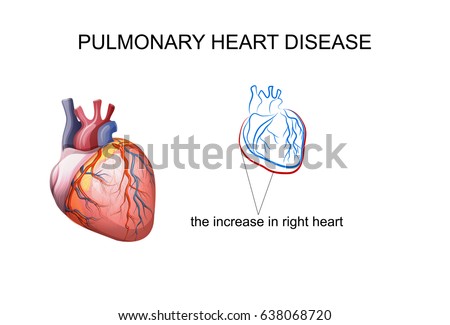 heart and lung diseases Tachycardia caused by heart or lung disease often is accompanied by chest pain or shortness of breath or lightheadedness diagnosis your doctor will ask you to describe your symptoms he or she will review your personal medical history and potential causes of tachycardia. heart and lung diseases Tachycardia caused by heart or lung disease often is accompanied by chest pain or shortness of breath or lightheadedness diagnosis your doctor will ask you to describe your symptoms he or she will review your personal medical history and potential causes of tachycardia.
