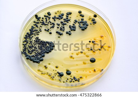 Colonies Black Bacteria Culture On Tcbs Stock Photo 475322866 ...