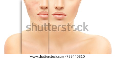 Puberty Stock Images, Royalty-Free Images & Vectors | Shutterstock