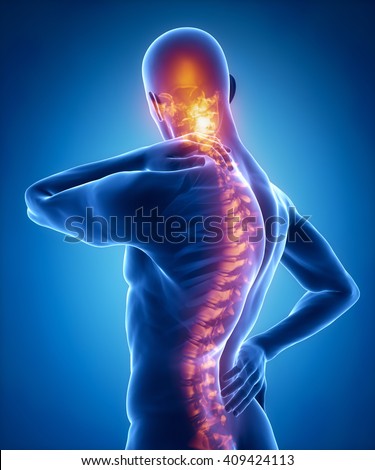 Spine injury pain in sacral and cervical region concept