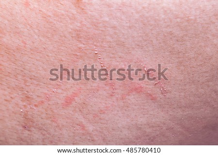 Sport Injury Painful Knee Wound Accident Stock Photo 594209333 ...