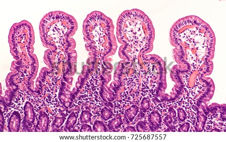 Villi Stock Images, Royalty-Free Images & Vectors | Shutterstock