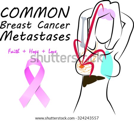 Metastasis Stock Vectors, Images & Vector Art | Shutterstock