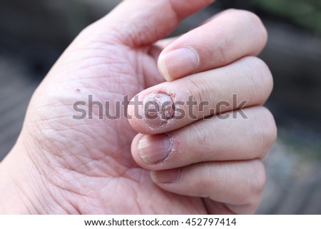 Deformed Hands Stock Photos, Images, & Pictures | Shutterstock